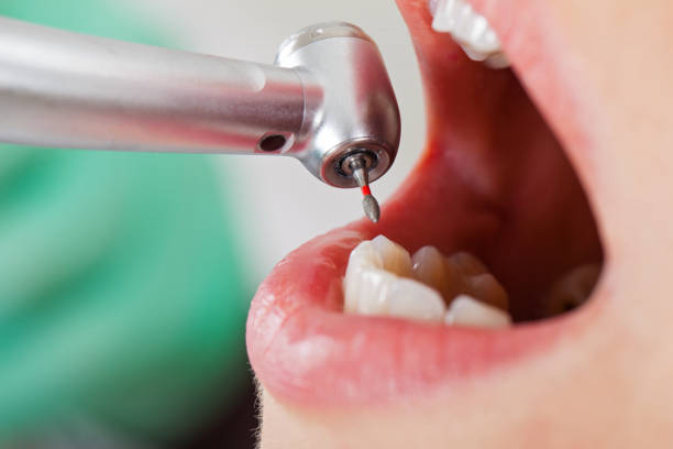 Best Holiday Emergency Dentist in Lacy Lakeview, TX